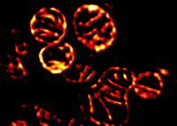 SIM stain of mitochondria in Cellvis glass bottom dish
